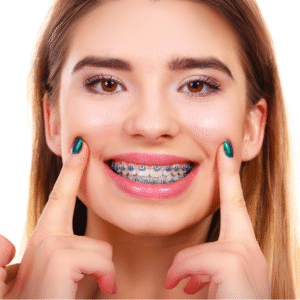 Aparelho Ortodôntico: quando é indicado